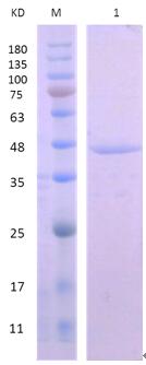 15% SDS-PAGE analysis profiles of purified PA1441-1-427 (CBB stained).